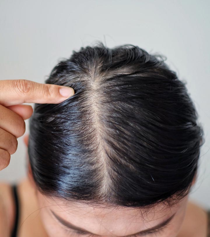 Dry Scalp Condition and Treatment